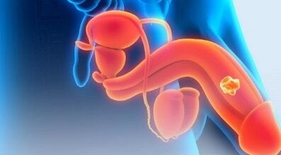 Exercícios para aumentar um membro