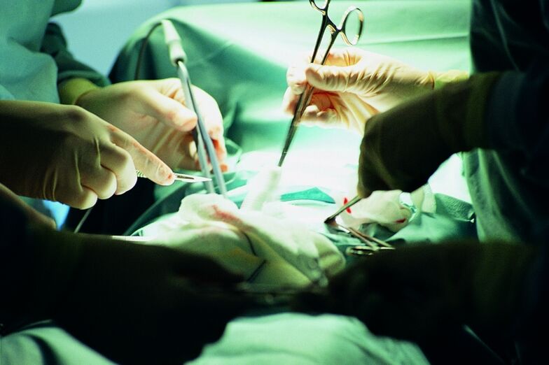 aumento cirúrgico da espessura do pênis